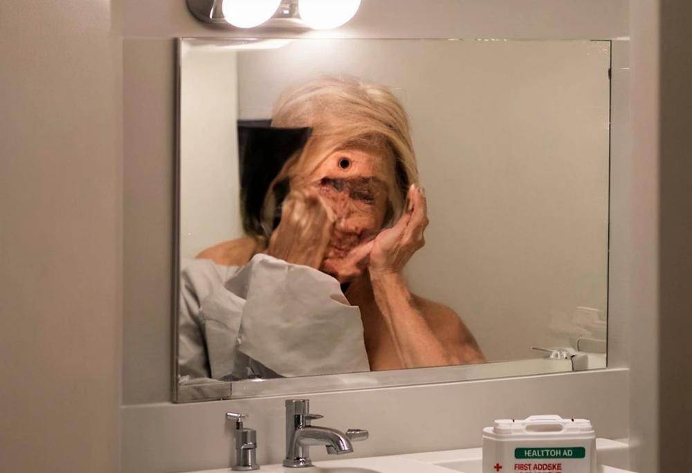 skin examination